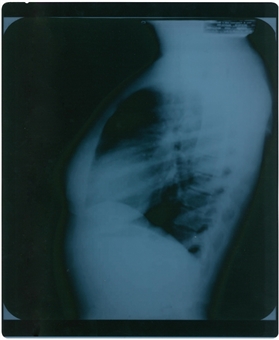 1954 Marilyn Monroe Chest X-Ray from Lebanon Hospital Dated 11-10-54 17x13.5"   